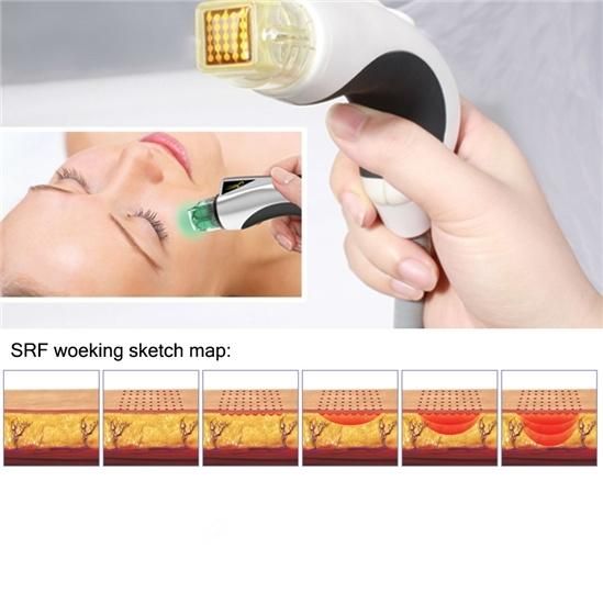 2015 High Recommend Srf+Cryo+PDT Microneedle Radio Frequency Beauty Machine (MR18-2S)