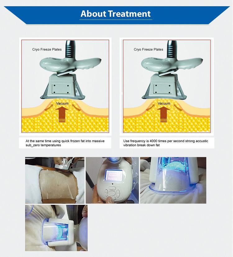 Renlang Cryolipolysis System Portable Vacuum Body Slimming Fat Freezing Machine