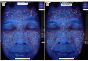 Beauty Salon Equipment Facial Skin Analyzer with Six Spectrums Skin Analysis