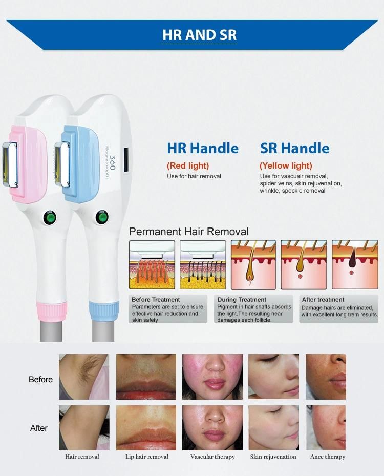 Popular Vertical IPL Hair Removal Machine with Double Shr Handle