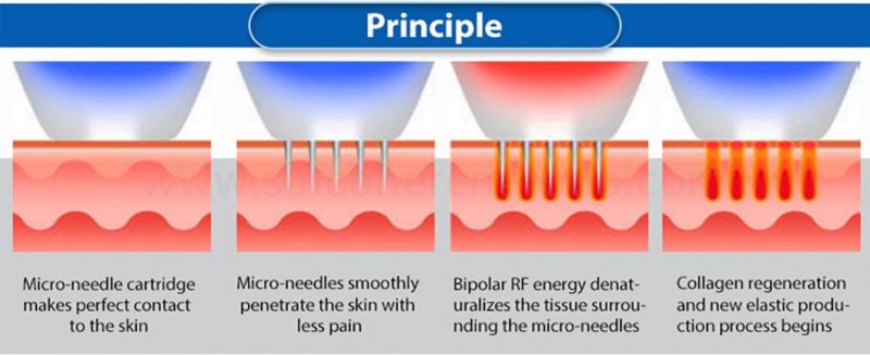 Safety Needles System Micro Needle Fractional RF Beauty Machine/RF Microneedle Fractional/Fractional RF