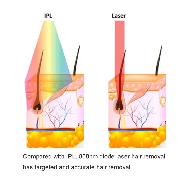 Hot Sale Laser Machine Cutting Machine Beauty Equipment Wholesale Beauty Machine Hair Removal Laser Equipment 808nm Diode Laser Hair Removal Machine