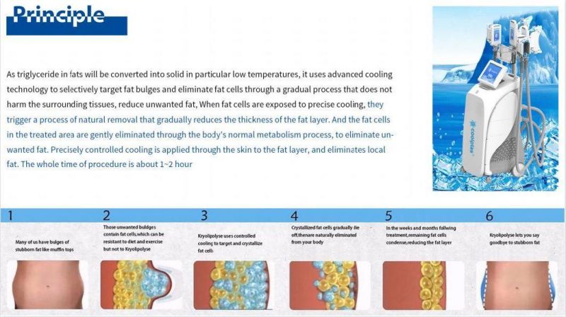 4 Handles Coolplas Fat Reduction 80%off Body Slimming Coolplas 360 Cryo Reduce Cooling System Body Shaping Lipo Reduce