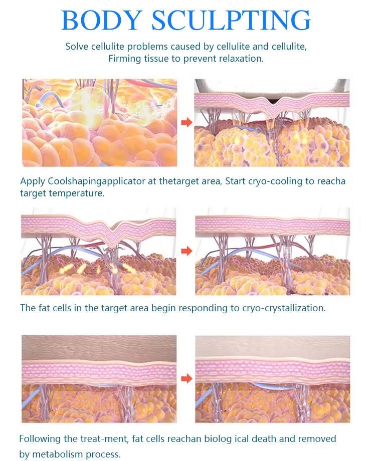 OEM Faster Fat Reduction 360 Cooling Machine Cryotherapy Slimming Machine Mslcy168