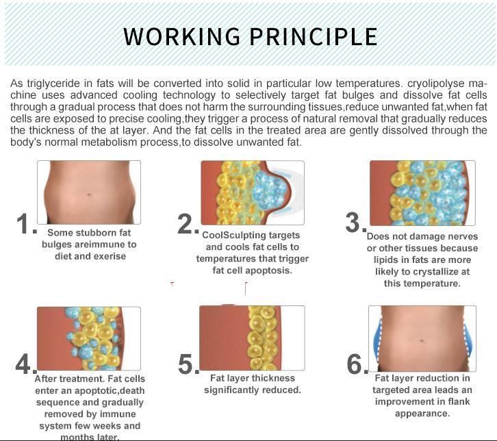 Fat Freezing Crylipolysis Fat Removal Machine 4 Handles Vacuum Best Cryoliposis Machine for Fast Body Slimming Weight Loss Machine