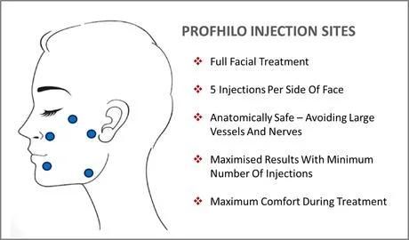 Latest Multi-Purpose Injectable Treatment Profhilo 64mg More Hyaluronic Acid for Skin Rejuvenation Hydration and Collagen Stimulation Time Reversing Injection