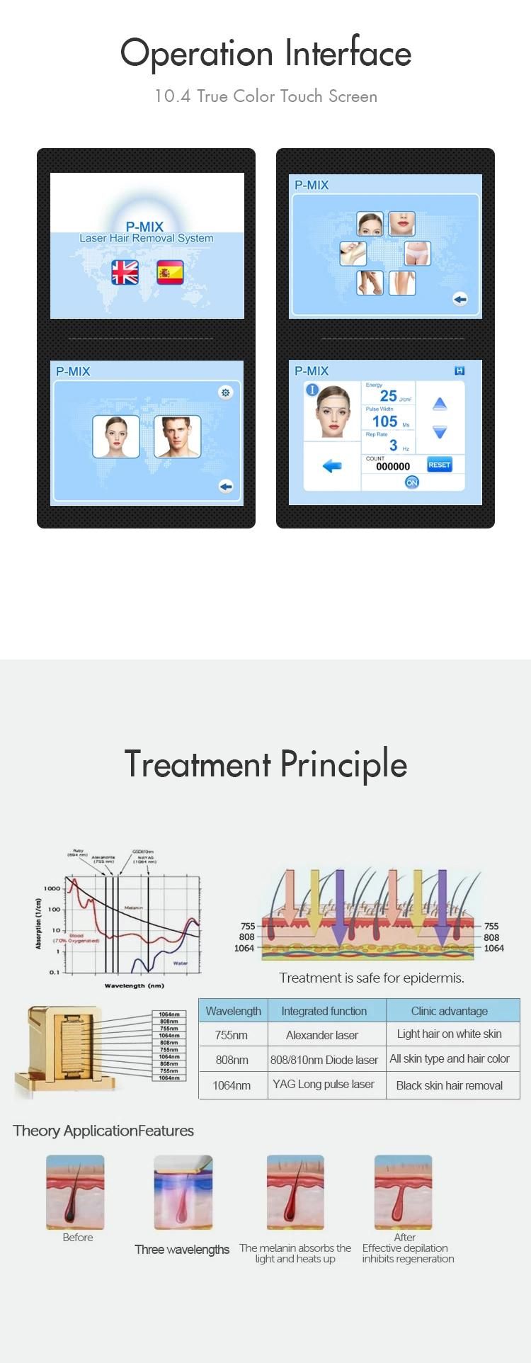 808/755/1064 Hair Removal Laser Machine