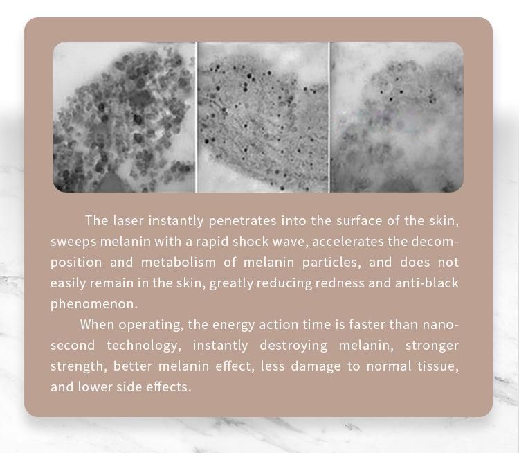 Best Effect! ! ! Vertical Pico Laser / Picosecond Laser Tattoo Removal Machine for Sale