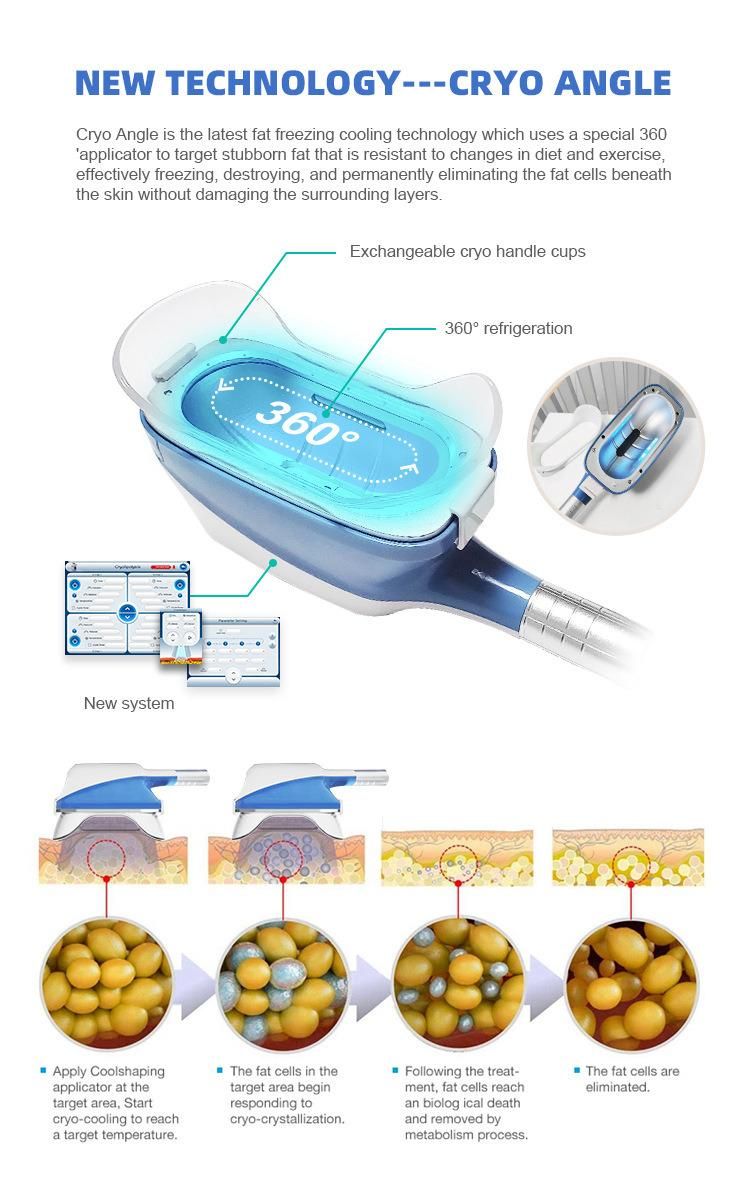 3handles Fat Freezing Fat Reduction Cryolipolysis Machine