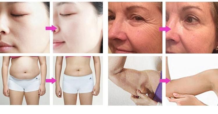 4 in 1 Cavitation Vacuum RF Slimming Skin Tightening Machine