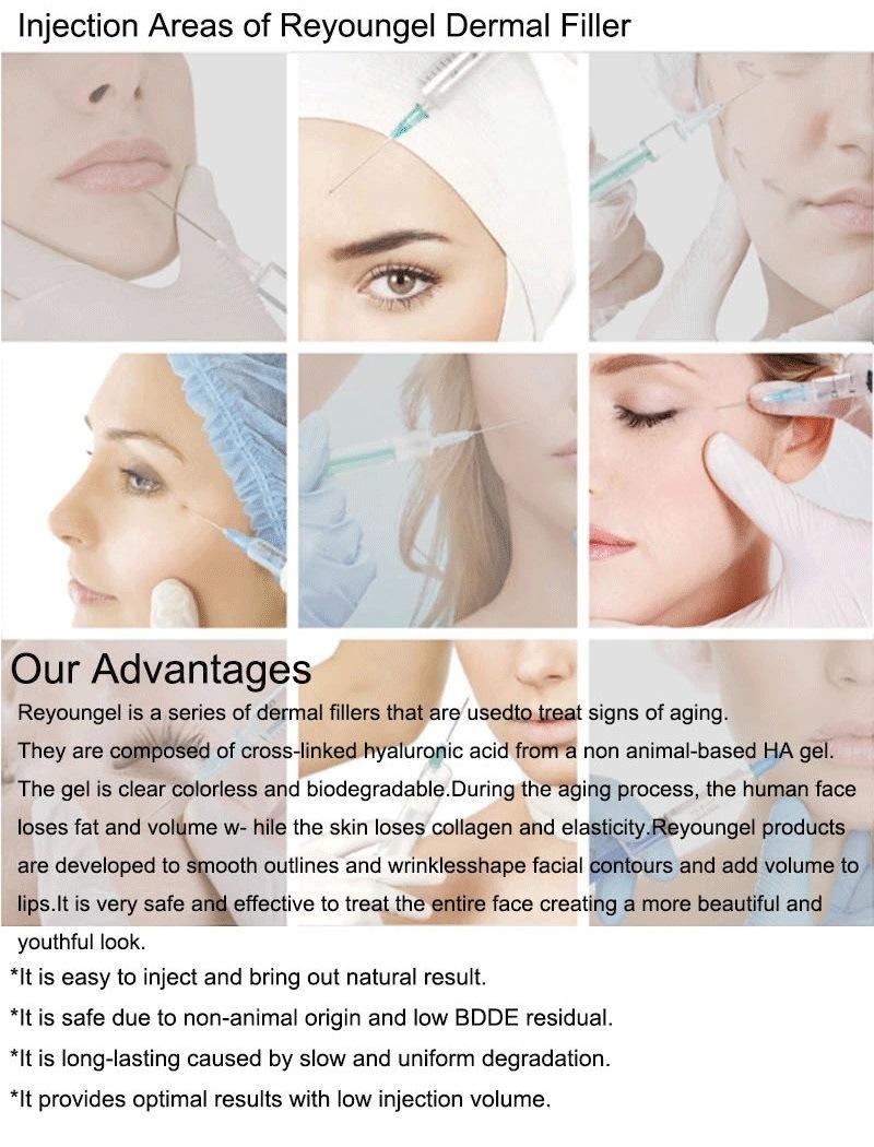 Reyoungel Wholesale Face Hyaluronic Acid Dermal Injectable Nose Face Gel Filler