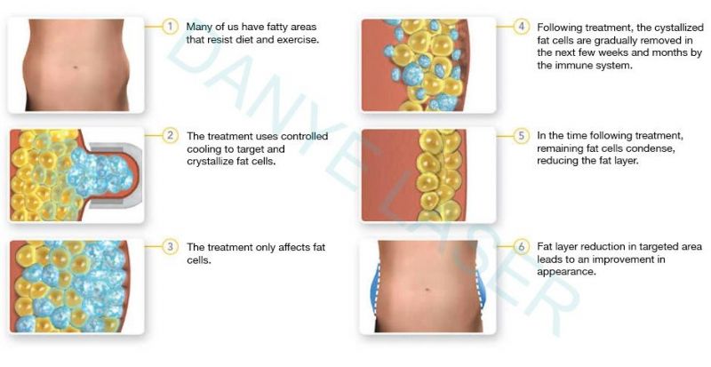 Danye Factory 360 Cryolipolysis Aluminium Cavitacion Radiofrecuencia Slimming Machine