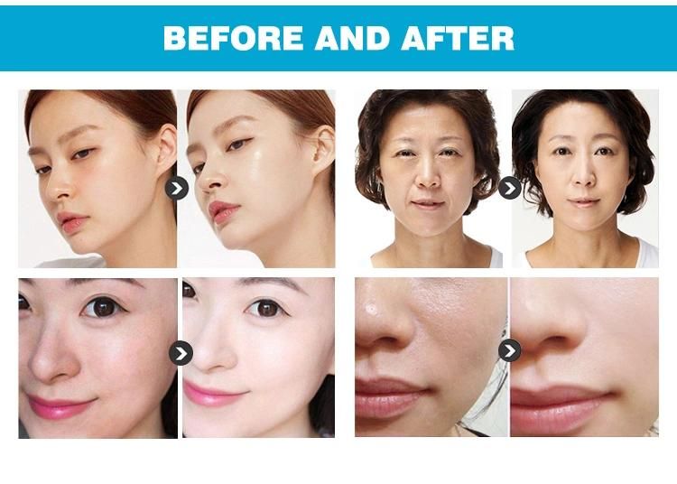 Portable Ultrasonic Skin Scrubber Face Peeling Cleaner