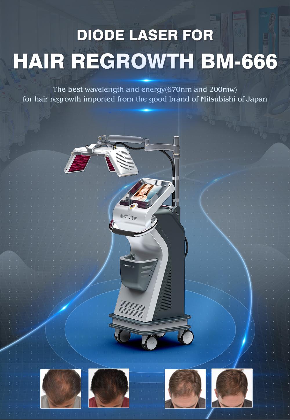 670nm Best Wavelenght Diode Laser Hair Regrowth Machine