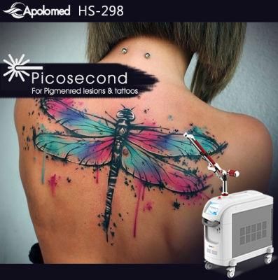 Dermatology Picosecond Laser Beauty Equipment Picosecond Laser for All Colour Tattoo Removal with Best Factory Price