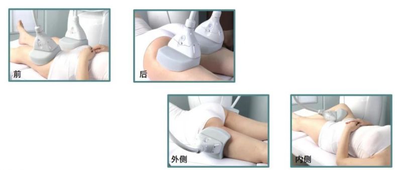 CE Approved Fat Freezing Weight Loss Cryolipolysis Fat Freezing Machine