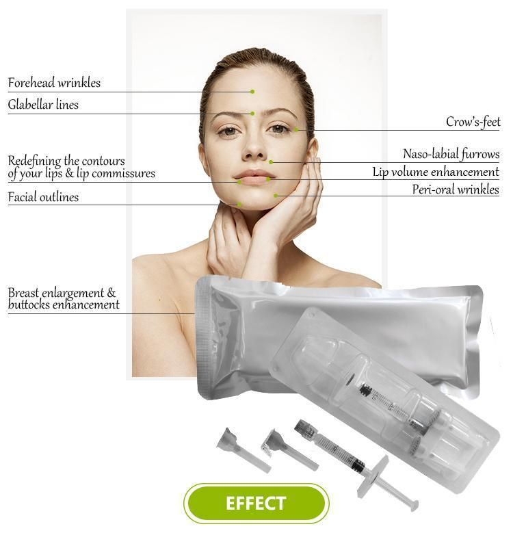 Cross Linked Deep Ha 2ml Injectable Filler Hyaluronic Acid Injection