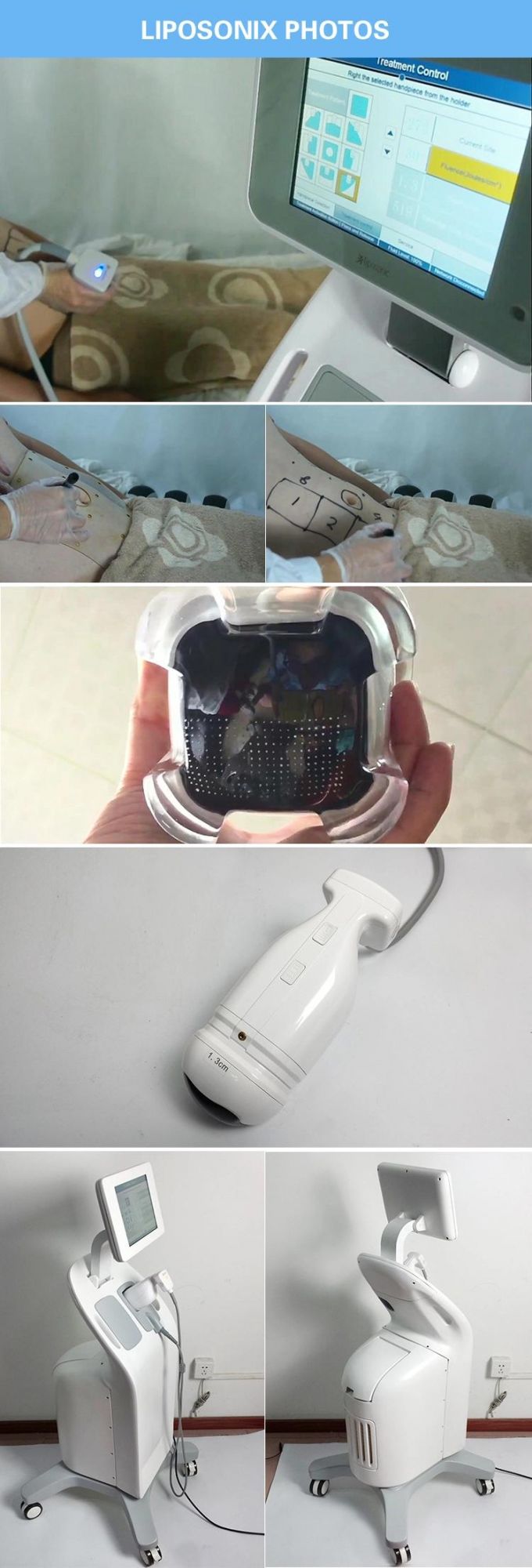 Weight Loss Ultrasound Machine/Liposonix/Ultrasound Machine Price
