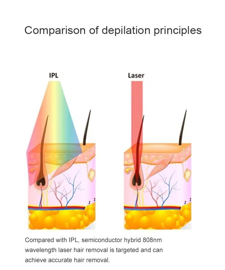 New Upgraded Diode Laser 808nm for Hair Removal and Depilation 3 Wave 755nm 808nm 1064nm Diode Laser