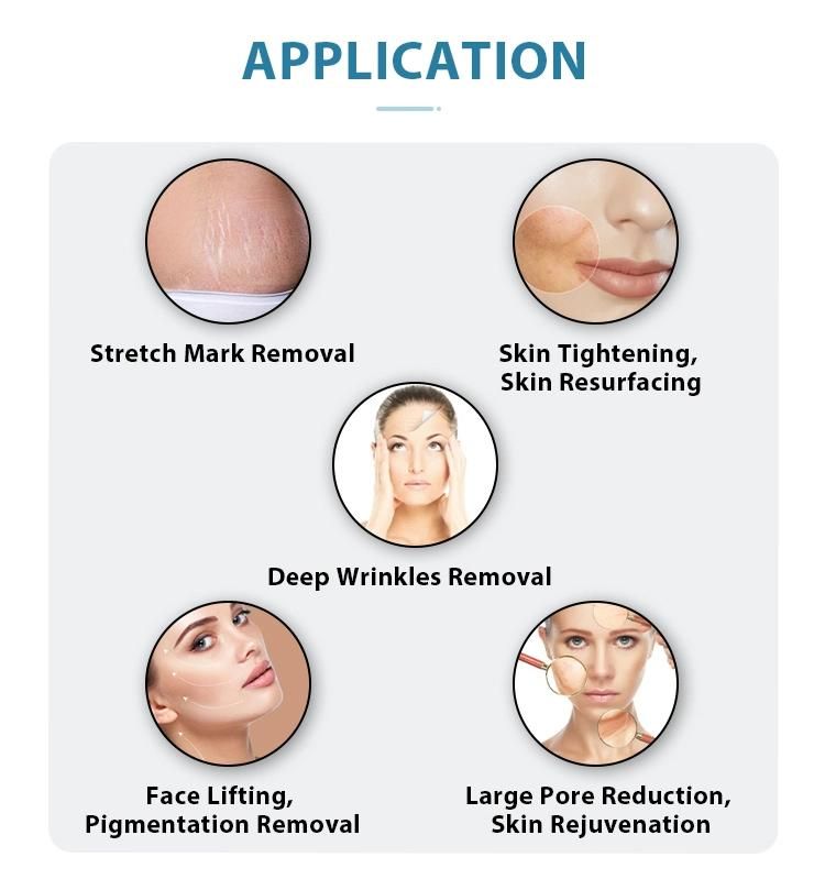 Skin Tightening Fractional RF Microneedle RF Wrinkles Removal