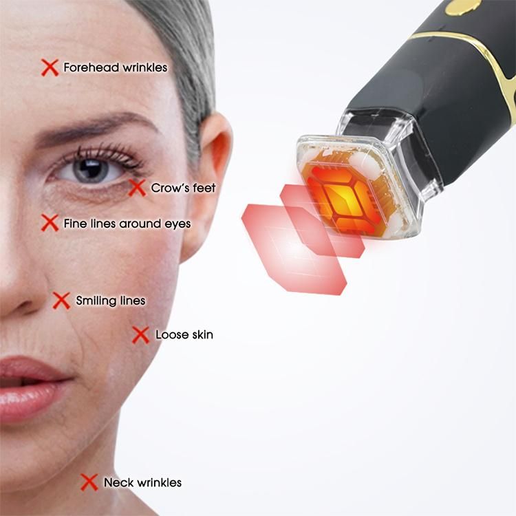 2022 Best RF Skin Tightening Face Lifting Machine Thermagic Portable RF Fractional Home Use Device