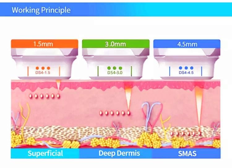 Mini Ultrasonic Hifu Face Lifting Wrinkle Removal Machine