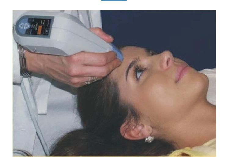 Portable Ultrasonic Wrinkle Removal and Fat Reduction RF Machine