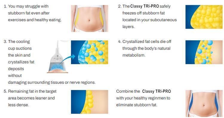 Body Sculpting Fat Reduction Cryolipolysis Machine for Beauty Salon Price