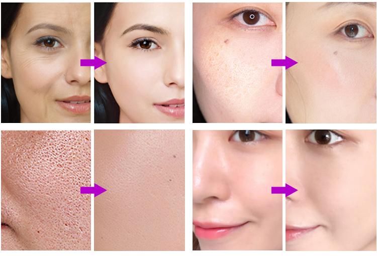 Beauty Salon Steam Face Moisturizing Skin Deep Cleaning Facial Steamer Mask