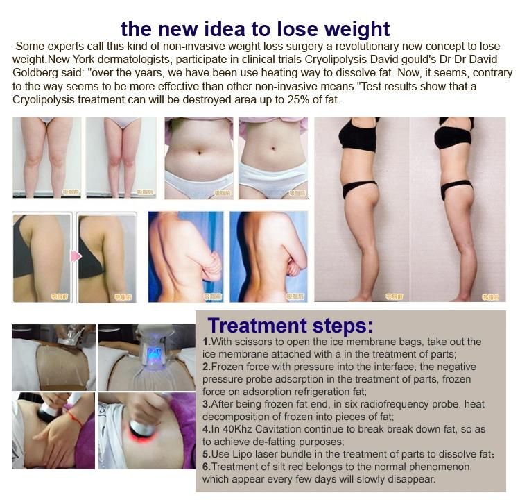 Fat Slimming Lipo Laser Fat Reduction Cryolipolysis Fat Freezing Machine
