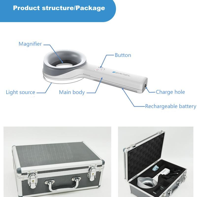 UVA Light+White light Home Use Skin Analyzer Dermatoscope for Medical Examination Illumination