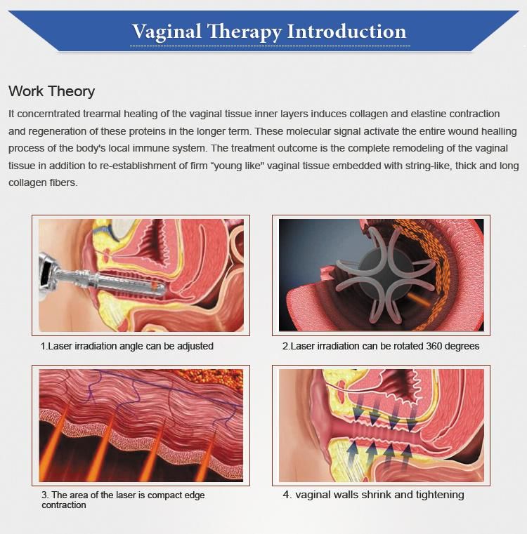 Vertical Style Fractional CO2 Laser Vaginal Tightening Scar Removal Medical Equipments