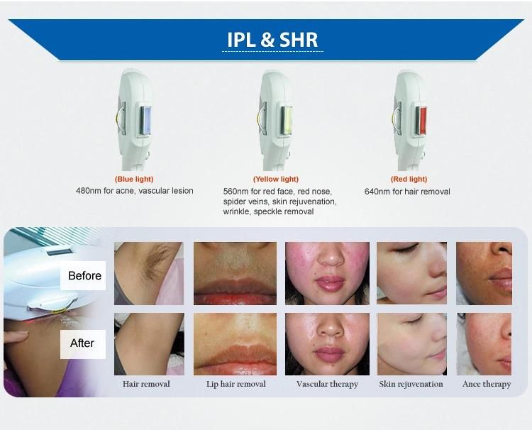 Permanent IPL Shr Laser Hair Removal Machine