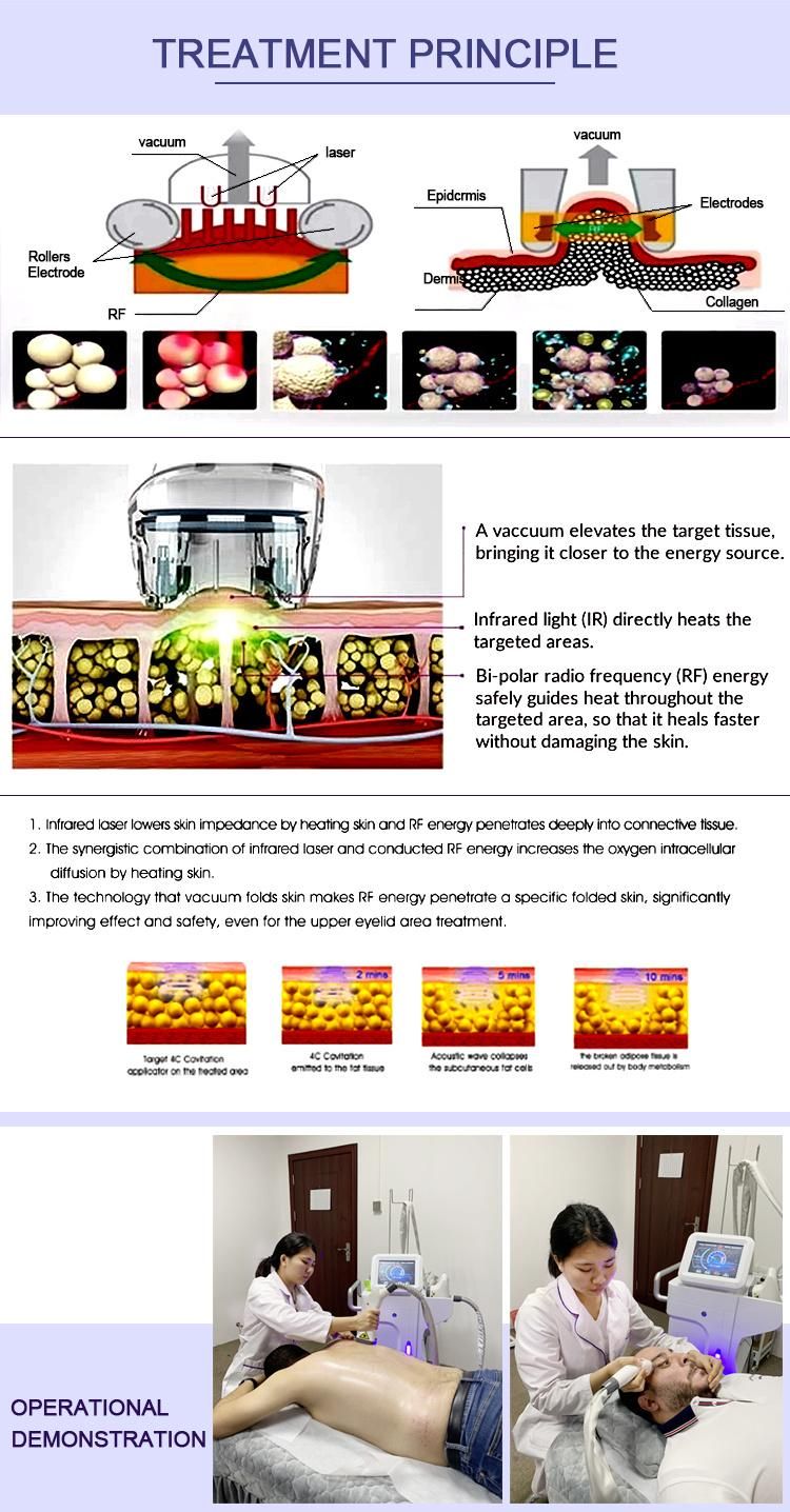 2021 Powerful V68 Hi-Tech! Vela Body Shape for Cellulite Reduction & Body Shaping Machine