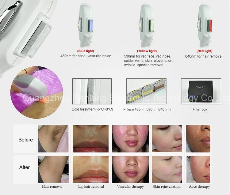 ND YAG Laser + IPL Shr + RF Technology Multifunction Beauty Machine