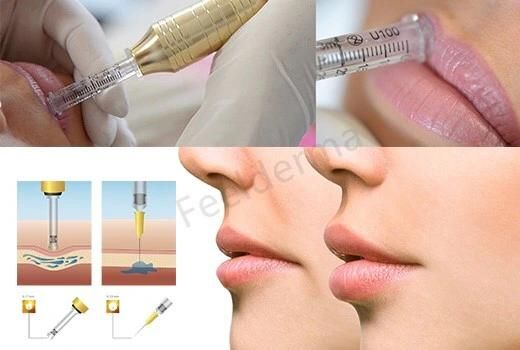Needle Free Hyaluronic Acid Lip Dermal Filler Hyaluronic Pen Injector No Pain 24K Hyaluronan Pen