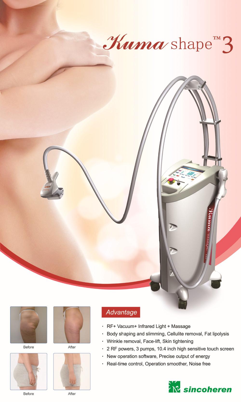 Fast Body Slimming Machine Kuma Shape 3 Cellulite Removal! Instant Remove Facial