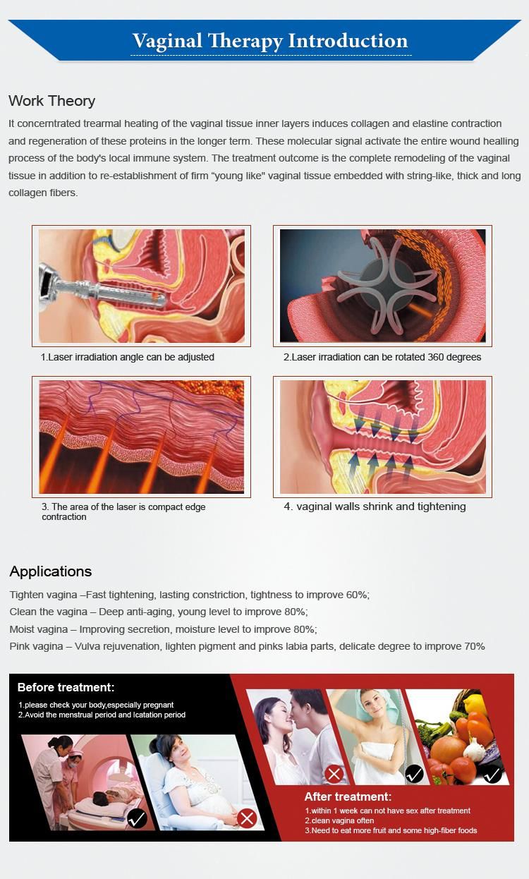 Renlang Beauty Machine CO2 Laser Machine Vaginal Tightening China Supplier