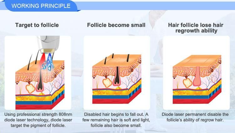 Depiladora Laser Profecional Hair Removal Diodenlaser 808 for Whole Body Hair Removal