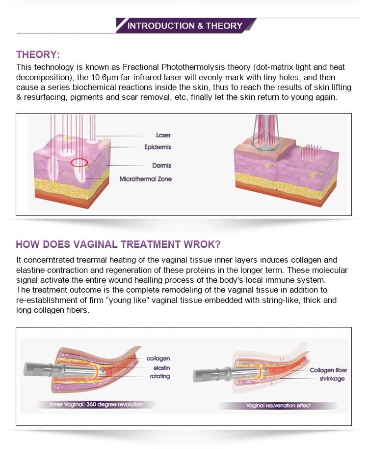 Hot Selling CO2 Fractional Laser Machine for Acne Scar Removal