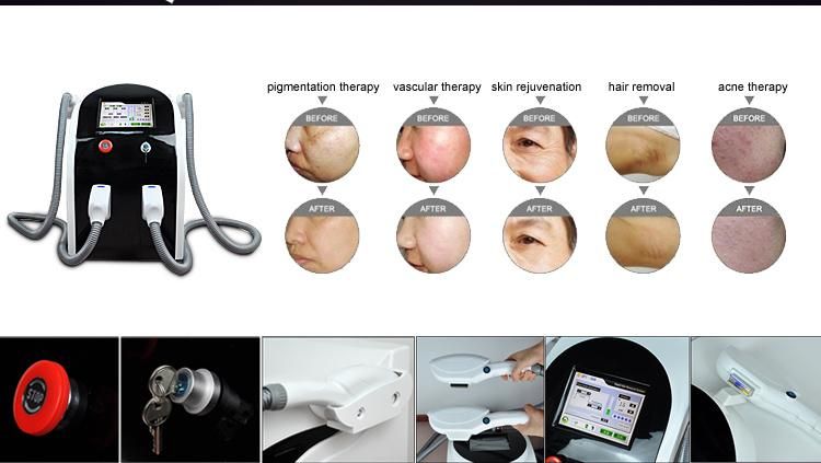 2018 Portable Elight Double Opt IPL Hair Removal Machine with Ce Approval