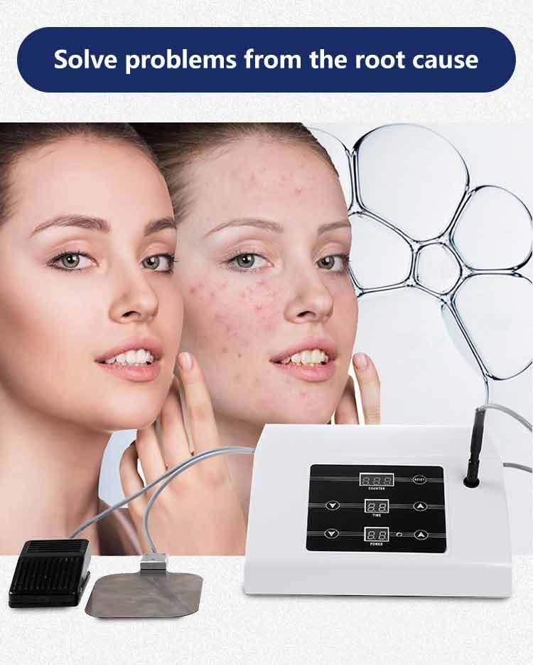 2019 Acne Removal Machine Body Acne Treatment