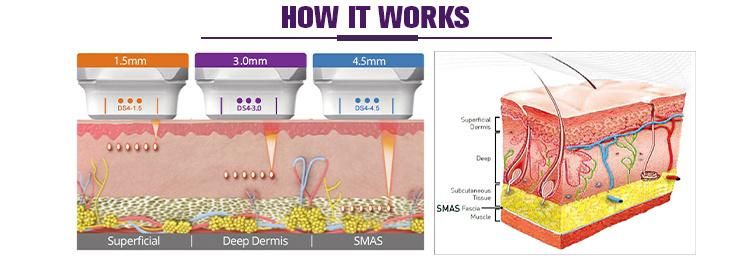 Professional Hifu Wrinkle Removal Anti-Aging Skin Tightening Machine