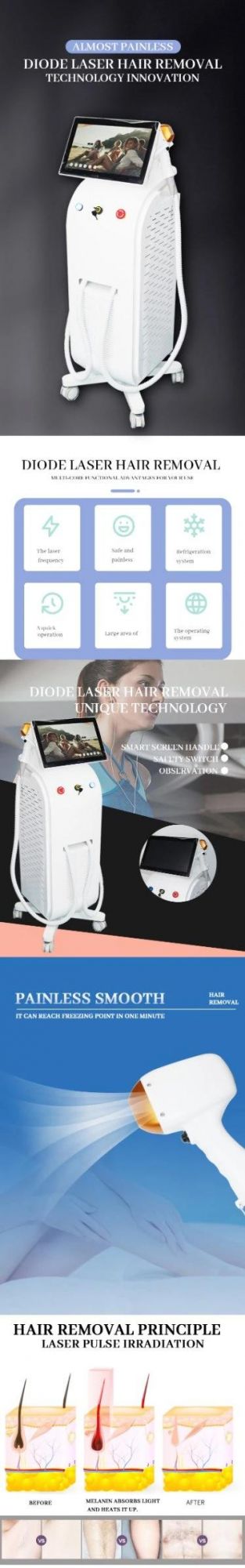 808nm Diode Laser Hair Removal Machine Equipment Price