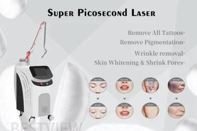 Professional Beauty Equipment Super Picosecond Laser Machine Supplier