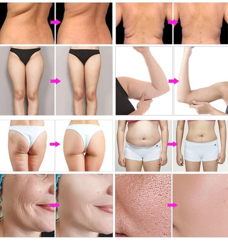 9 in 1 Multifunction Beauty Machine Lipolaser Cavitation Vacuum RF Slimming Machine