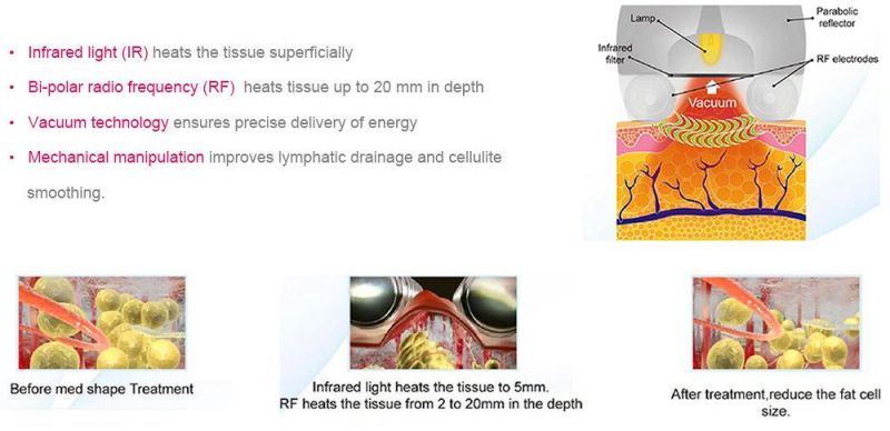 Radiofrequency Concept Legacy/ - Fractora/ Lifting Fese RF Kuma X Perfect Shaping Machine Sincoheren