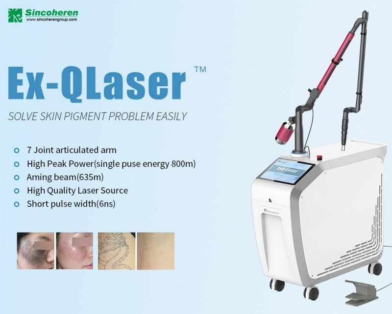 Fast Treatment Medical CE ND YAG Q- Switched Tattoo Removal Machine ND YAG Painless Laser Pigmentation Removal Machine