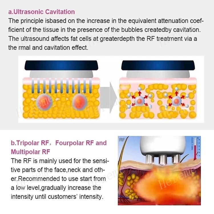 Multi Functional Five-in-One Ultrasonic Slimming and Fat Reducing Instrument