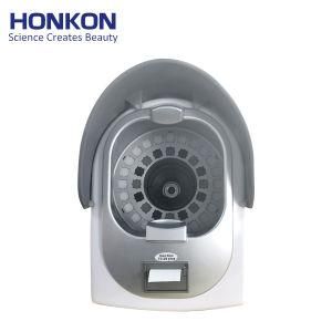 Honkon Portable Skin Analyzer Machine/Skin Analysis Machine Tc-20plus